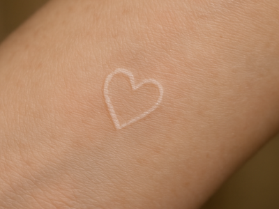 Close-up photograph of a healed white ink tattoo on a forearm
